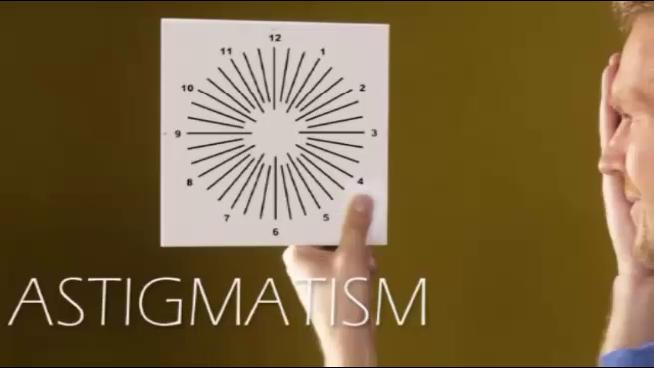 Astigmatism